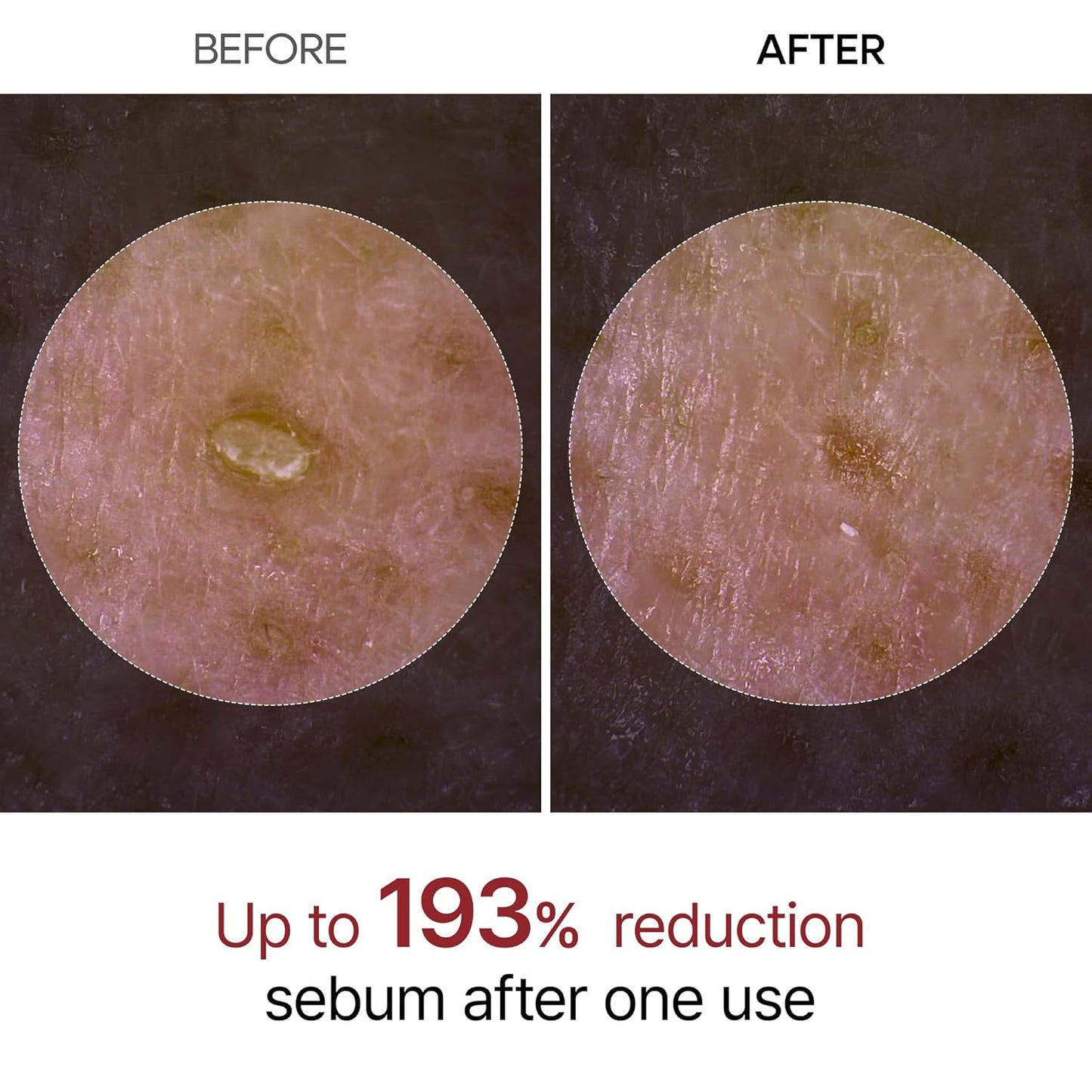 Hydrating PeelShot™ Glow Ampoule Duo Peel
