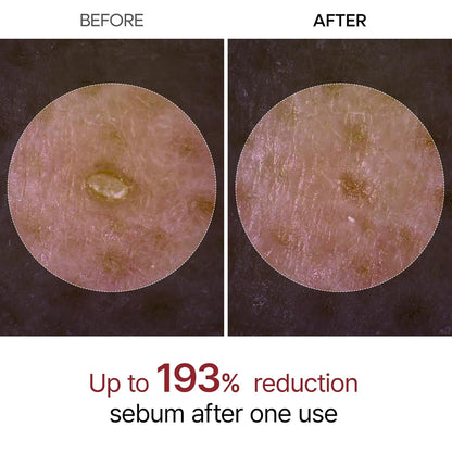 Hydrating PeelShot™ Glow Ampoule Duo Peel